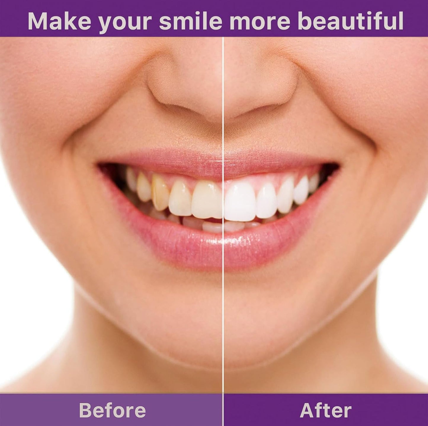 🦷Clinclii™ V36 Whitening Strips – Professional Teeth Whitening at Home(UPGRADED VERSION)