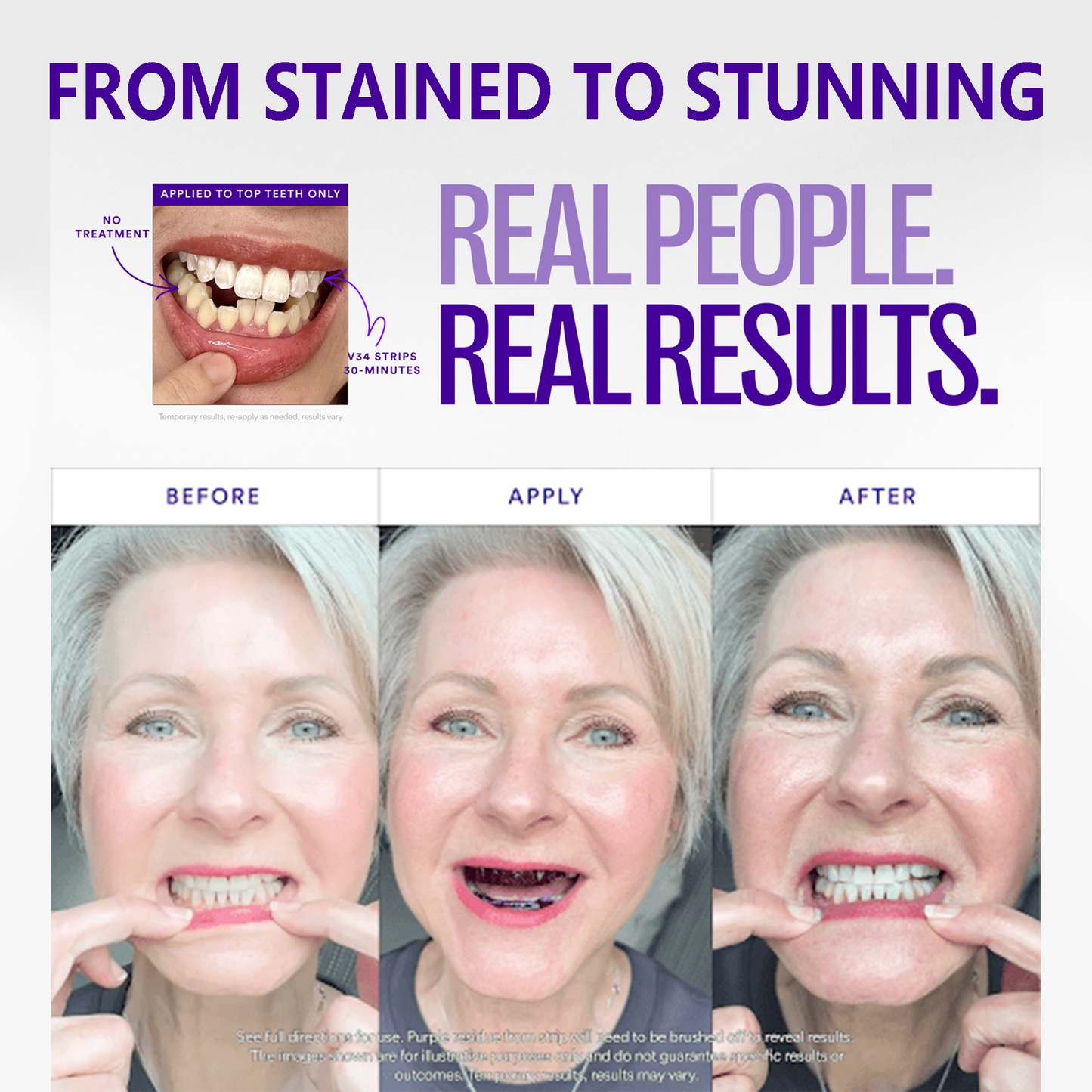🦷Clinclii™ V36 Whitening Strips – Professional Teeth Whitening at Home(UPGRADED VERSION)